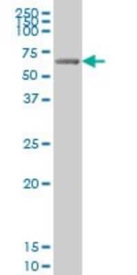 Western Blot: GRK6 Antibody (8B7) [H00002870-M07] - GRK6 monoclonal antibody (M07), clone 8B7 Western Blot analysis of GRK6 expression in MCF-7 [L046V1].