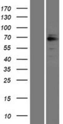 Western Blot GRK6 Overexpression Lysate