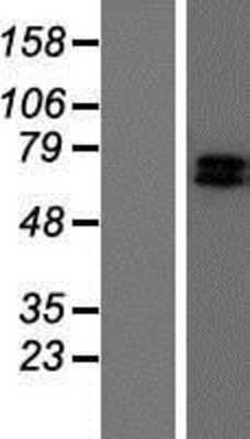 Western Blot GRK6 Overexpression Lysate