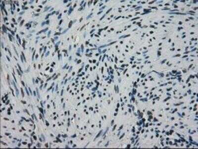 Immunohistochemistry: GRP75/HSPA9B/Mortalin Antibody (OTI9F8) - Azide and BSA Free [NBP2-70963] - Staining of paraffin-embedded Human endometrium tissue using anti-GRP75/HSPA9B/Mortalin mouse monoclonal antibody.