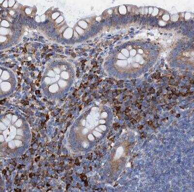Immunohistochemistry-Paraffin: GRP78/HSPA5 Antibody [NBP1-89968] - Staining of human appendix shows strong cytoplasmic positivity in lymphoid cells.