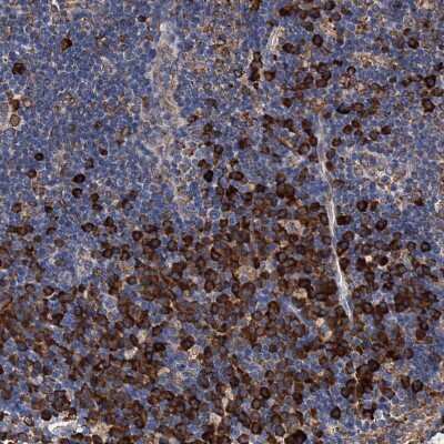 Immunohistochemistry-Paraffin: GRP78/HSPA5 Antibody [NBP1-89968] - Staining of human lymph node shows strong cytoplasmic positivity in non-germinal center cells.
