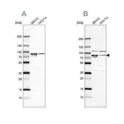 Western Blot: GRP78/HSPA5 Antibody [NBP1-89968] - Analysis using Anti-HSPA5 antibody NBP1-89968 (A) shows similar pattern to independent antibody NBP1-89969 (B).