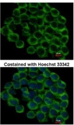 Immunocytochemistry/Immunofluorescence: gp96/HSP90B1/GRP94 Antibody [NBP1-32118] - GRP94 Antibody [NBP1-32118] - Analysis of methanol-fixed HCT116, using antibody at 1:500 dilution.