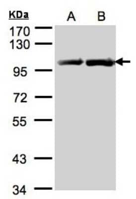 Western Blot: gp96/HSP90B1/GRP94 Antibody [NBP1-32118] - GRP94 Antibody [NBP1-32118] - Sample(30 ug of whole cell lysate)A:293TB:A431 7. 5% SDS PAGE, antibody diluted at 1:1500.