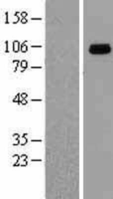 Western Blot gp96/HSP90B1/GRP94 Overexpression Lysate