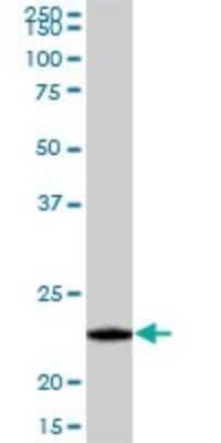 Western Blot: GRPEL1 Antibody [H00080273-B01P] - Analysis of GRPEL1 expression in Jurkat.