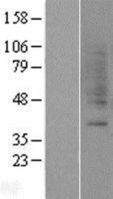 Western Blot: GRPR Overexpression Lysate (Adult Normal) [NBP2-04290] Left-Empty vector transfected control cell lysate (HEK293 cell lysate); Right -Over-expression Lysate for GRPR.
