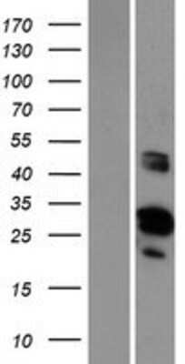 Western Blot GRRP1 Overexpression Lysate
