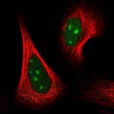 Immunocytochemistry/ Immunofluorescence GRWD1 Antibody