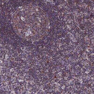 Immunohistochemistry-Paraffin: GRWD1 Antibody [NBP1-81790] - Staining of human lymph node shows nuclear positivity.