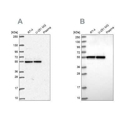 Western Blot GRWD1 Antibody