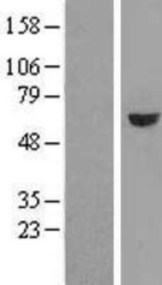 Western Blot: GRWD1 Overexpression Lysate (Adult Normal) [NBL1-11356] Left-Empty vector transfected control cell lysate (HEK293 cell lysate); Right -Over-expression Lysate for GRWD1.