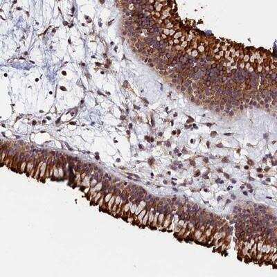 Immunohistochemistry-Paraffin: GRXCR1 Antibody [NBP1-90591] - Staining of human nasopharynx shows strong cytoplasmic and membranous positivity in respiratory epithelial cells.