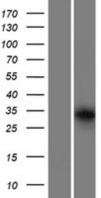 Western Blot: GRXCR1 Overexpression Lysate (Adult Normal) [NBP2-08337] Left-Empty vector transfected control cell lysate (HEK293 cell lysate); Right -Over-expression Lysate for GRXCR1.