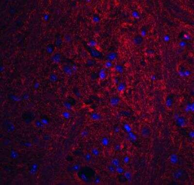 Immunocytochemistry/Immunofluorescence: GSAP Antibody [NBP2-81894] - Analysis of GSAP in mouse brain tissue with GSAP antibody at 20 ug/ml. Red: GSAP antibody [NBP2-81894]. Blue: DAPI staining