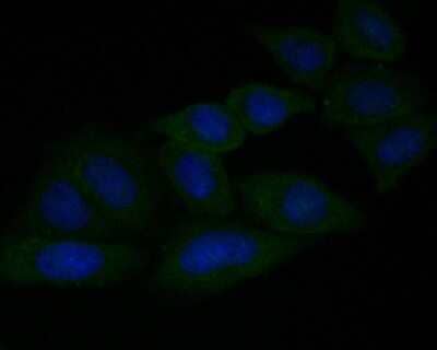 Immunocytochemistry/Immunofluorescence: GSDMDC1 Antibody [NBP2-80427] - Staining of Gasdermin D in SiHa cells (green). Formalin fixed cells were permeabilized with 0.1% Triton X-100 in TBS for 10 minutes at room temperature and blocked with 1% Blocker BSA for 15 minutes at room temperature. Cells were probed with the primary antibody (ER1901-37, 1/50) for 1 hour at room temperature, washed with PBS. Alexa Fluor488 Goat anti-Rabbit IgG was used as the secondary antibody at 1/1,000 dilution. The nuclear counter stain is DAPI (blue).