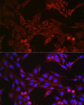 Immunocytochemistry/Immunofluorescence: GSDMDC1 Antibody [NBP2-93428] - Immunofluorescence analysis of NIH/3T3 cells using GSDMDC1 Rabbit pAb (NBP2-93428) at dilution of 1:250 (40x lens). Blue: DAPI for nuclear staining.