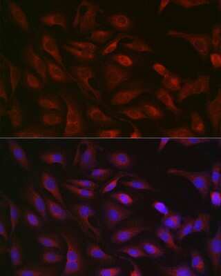 Immunocytochemistry/Immunofluorescence: GSDMDC1 Antibody [NBP2-93428] - Immunofluorescence analysis of U2OS cells using GSDMDC1 Rabbit pAb (NBP2-93428) at dilution of 1:250 (40x lens). Blue: DAPI for nuclear staining.