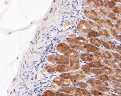 Immunohistochemistry-Paraffin: GSDMDC1 Antibody [NBP2-80427] - Analysis in rat stomach tissue using GSDMDC1 antibody. The section was pre-treated using heat mediated antigen retrieval with sodium citrate buffer (pH 6.0) for 20 minutes. The tissues were blocked in 5% BSA for 30 minutes at room temperature, washed with