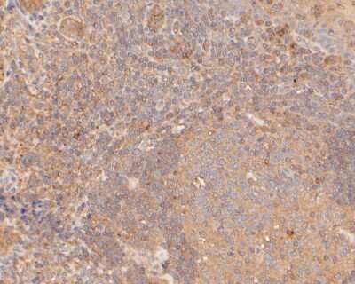 Immunohistochemistry-Paraffin: GSDMDC1 Antibody [NBP2-80427] - Analysis in human tonsil tissue using GSDMDC1 antibody. The section was pre-treated using heat mediated antigen retrieval with sodium citrate buffer (pH 6.0) for 20 minutes. The tissues were blocked in 5% BSA for 30 minutes at room temperature, washed wit