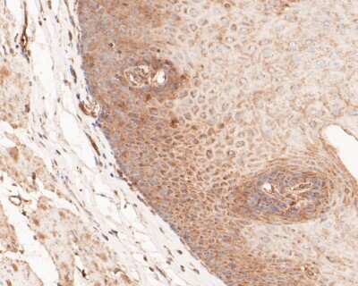 Immunohistochemistry-Paraffin: GSDMDC1 Antibody [NBP2-80427] - Analysis in human esophagus tissue using GSDMDC1 antibody. The section was pre-treated using heat mediated antigen retrieval with sodium citrate buffer (pH 6.0) for 20 minutes. The tissues were blocked in 5% BSA for 30 minutes at room temperature, washed