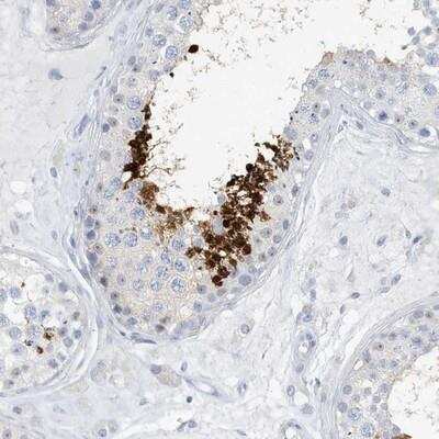 Immunohistochemistry-Paraffin: GSE1 Antibody [NBP1-86292] - Staining of human testis shows strong cytoplasmic and nuclear positivity in spermatids.