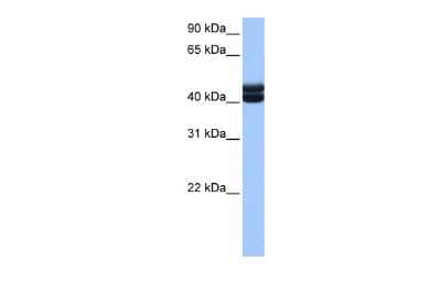 Western Blot: GSG1 Antibody [NBP2-84054] - WB Suggested Anti-GSG1 Antibody Titration: 0.2-1 ug/ml. Positive Control: Human Liver