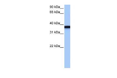 Western Blot: GSG1 Antibody [NBP2-84055] - WB Suggested Anti-GSG1 Antibody Titration: 0.2-1 ug/ml. Positive Control: NTERA2 cell lysate