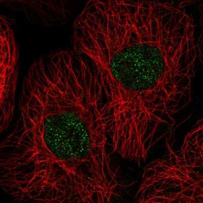 Immunocytochemistry/Immunofluorescence: GSG2 Antibody [NBP2-55174] - Staining of human cell line A-431 shows localization to nucleus.