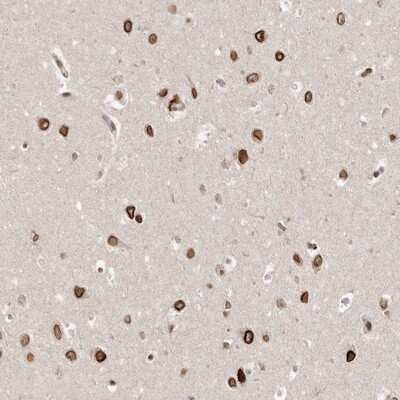 Immunohistochemistry-Paraffin: GSG2 Antibody [NBP1-81774] - Staining of human hippocampus shows strong nuclear membranous positivity in neuronal cells.