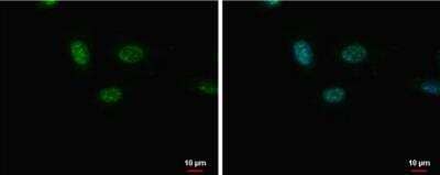 Immunocytochemistry/Immunofluorescence: GSH2 Antibody [NBP2-43705] - Analysis of Sample: SK-N-SH cells were fixed in 4% paraformaldehyde at RT for 15 min. Green: GSX2 protein stained by GSX2 antibody diluted at 1:200. Blue: Hoechst 33342 staining.