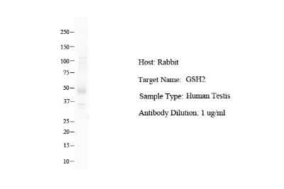 Western Blot: GSH2 Antibody [NBP2-86661] - Host: Rabbit. Target Name: GSH2. Sample Type: Human Testis. Antibody Dilution: 1.0ug/ml