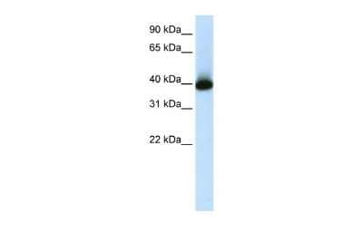 Western Blot GSH2 Antibody