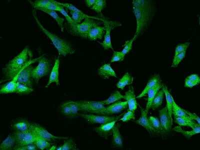 Immunocytochemistry/Immunofluorescence: GSK-3 alpha Antibody [NBP2-97994] - Immunofluorescence staining of GSK-3 alpha in U251MG cells. Cells were fixed with 4% PFA, permeabilzed with 0.1% Triton X-100 in PBS, blocked with 10% serum, and incubated with rabbit anti-Human GSK-3 alpha polyclonal antibody (dilution ratio 1:200) at 4C overnight. Then cells were stained with the Alexa Fluor(R)488-conjugated Goat Anti-rabbit IgG secondary antibody (green) and counterstained with DAPI (blue).Positive staining was localized to Cytoplasm.