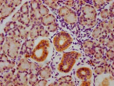 Immunohistochemistry: GSK-3 alpha [p Tyr216, p Tyr279] Antibody (4A5) [NBP3-15149] - IHC image of GSK-3 alpha antibody diluted at 1:100 and staining in paraffin-embedded human pancreatic tissue. After dewaxing and hydration, antigen retrieval was mediated by high pressure in a citrate buffer (pH 6.0). Section was blocked with 10% normal goat serum 30 minute at RT. Then primary antibody (1% BSA) was incubated at 4C overnight. The primary is detected by a biotinylated secondary antibody and visualized using an HRP conjugated SP system.