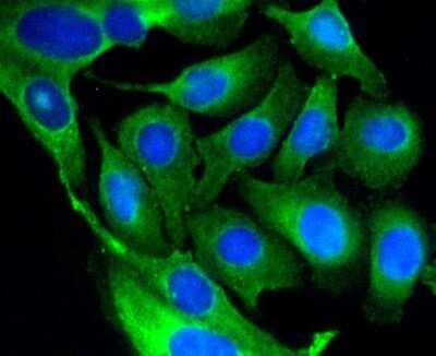 Immunocytochemistry/Immunofluorescence: GSK-3 beta Antibody (SY28-03) [NBP2-67448] - Staining GSK3 beta in SKOV-3 cells (green). The nuclear counter stain is DAPI (blue). Cells were fixed in paraformaldehyde, permeabilised with 0.25% Triton X100/PBS.