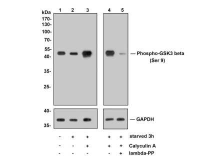 Western Blot: GSK-3 beta [p Ser9] Antibody (SY02-71) [NBP2-67444] - Analysis of GSK-3 beta [p Ser9] on Hela cell lysates. Lane 1 : Hela cells, whole cell lysate, 10ug/lane Lane 2 : Hela cells starved for 3 hours, whole cell lysates, 10ug/lane Lane 3/4 : Hela cells starved for 3 hours, then treated with 100nM Calyculin A for 30 minutes, whole cell lysates, 10ug/lane Lane 5 : Hela cells starved for 3 hours and treated with 100nM Calyculin A for 30 minutes, then treated with 2.8ug/ul lambda-PP for 30 minutes, whole cell lysates, 10ug/lane All lanes : Anti-GSK-3 beta [p Ser9] antibody at 1:500 dilution. Anti-GAPDH antibody at 1:10,000 dilution. Goat Anti-Rabbit IgG H&L (HRP) at 1/200,000 dilution. Predicted band size: 47 kDa Observed band size: 47 kDa Blocking and diluting buffer: 5% BSA. Exposure time: 1 minute 2 seconds