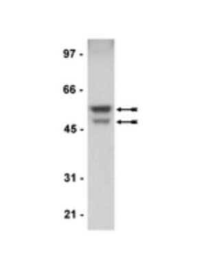 Western Blot: GSK3 alpha/beta Antibody [NBP2-29873] - HEK293 cell lysate was probed with anti-GSK3alpha /Beta  (1:5,000 dilution).  Arrows indicate GSK3alpha  (~51kDa) and GSK3Beta  (~46kDa).