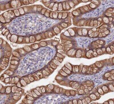 Immunohistochemistry-Paraffin: GSKIP Antibody [NBP2-30378] - Staining of human small intestine shows strong cytoplasmic positivity in goblet cells.