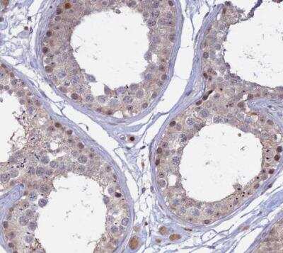 Immunohistochemistry-Paraffin: GSKIP Antibody [NBP2-30378] - Staining of human testis shows moderate nuclear positivity in cells in seminiferous ducts and leydig cells.