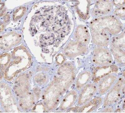 Immunohistochemistry-Paraffin: GSKIP Antibody [NBP2-30378] - Staining of human kidney shows moderate nuclear positivity in glomeruli and cells in tubules.