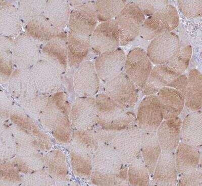 Immunohistochemistry-Paraffin: GSKIP Antibody [NBP2-30378] - Staining of human skeletal muscle shows moderate cytoplasmic and nuclear positivity in myocytes.