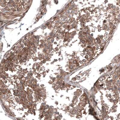 Immunohistochemistry-Paraffin: GSPT1 Antibody (CL13332) [NBP3-18565] - Staining of human testis shows moderate to strong cytoplasmic positivity in cells in seminiferous ducts.