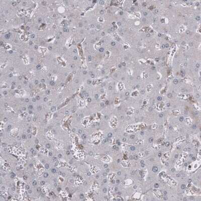 Immunohistochemistry-Paraffin: GSPT1 Antibody (CL13332) [NBP3-18565] - Staining of human liver shows no positivity in hepatocytes.