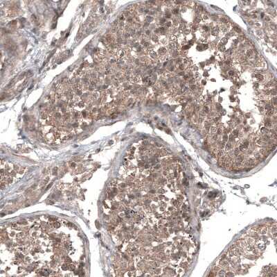 Immunohistochemistry-Paraffin: GSPT1 Antibody (CL13336) [NBP3-18559] - Staining of human testis shows moderate cytoplasmic positivity in cells in seminiferous ducts.