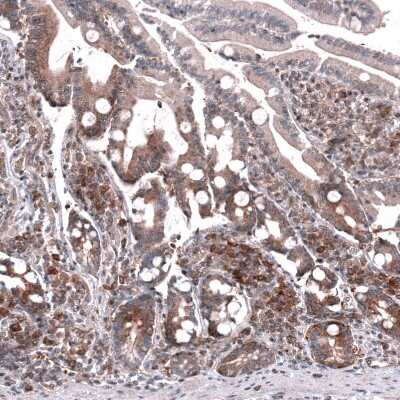 Immunohistochemistry-Paraffin: GSPT1 Antibody (CL13336) [NBP3-18559] - Staining of human duodenum shows moderate cytoplasmic positivity in glandular cells.