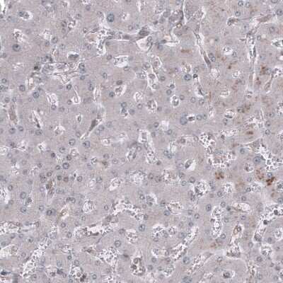 Immunohistochemistry-Paraffin: GSPT1 Antibody (CL13336) [NBP3-18559] - Staining of human liver shows no positivity in hepatocytes.