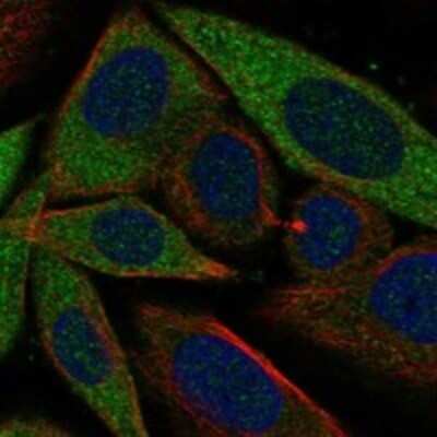 Immunocytochemistry/Immunofluorescence: GSPT1 Antibody [NBP3-17258] - Staining of human cell line SiHa shows localization to cytosol.