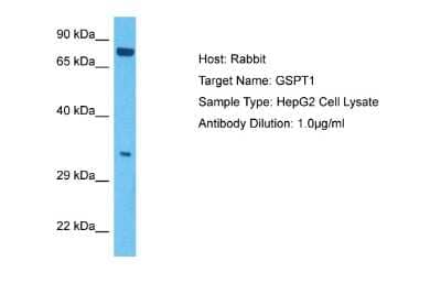 Western Blot: GSPT1 Antibody [NBP2-87531] - Host: Rabbit. Target Name: GSPT1. Sample Tissue: Human HepG2 Whole Cell. Antibody Dilution: 1ug/ml